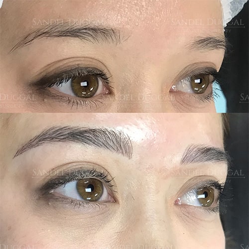 Microblading before and after, actual patient